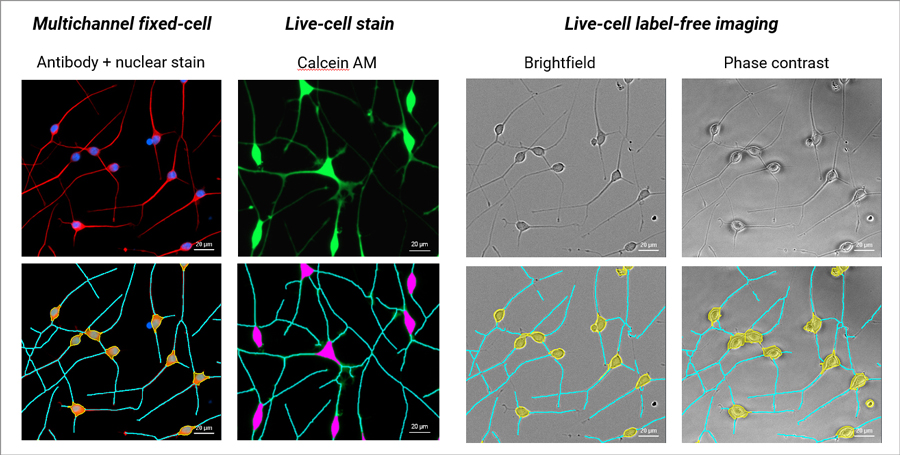 Supported neurite analysis imaging modes and associated applications.