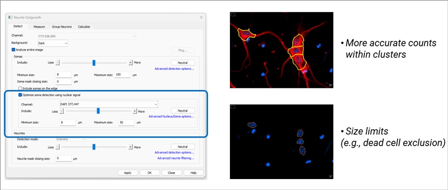 Tools and strategies for improved segmentation and quantification of soma using a nuclear label.