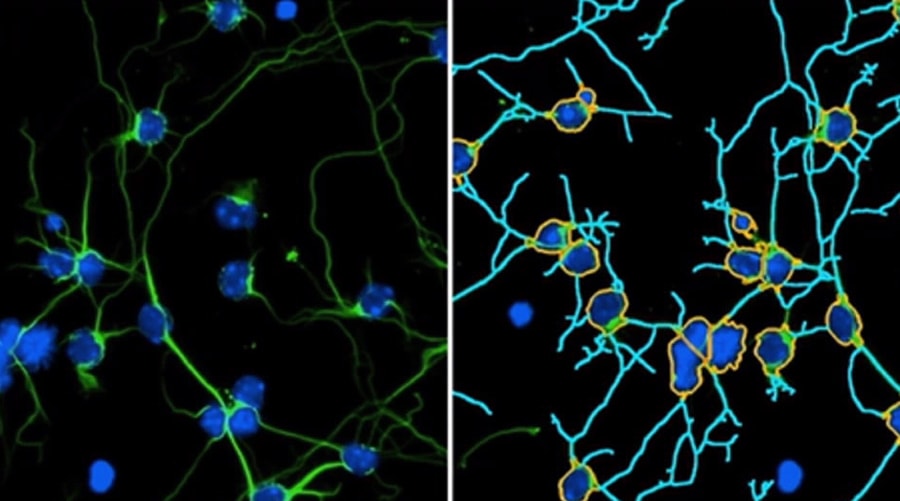 Neurite Outgrowth