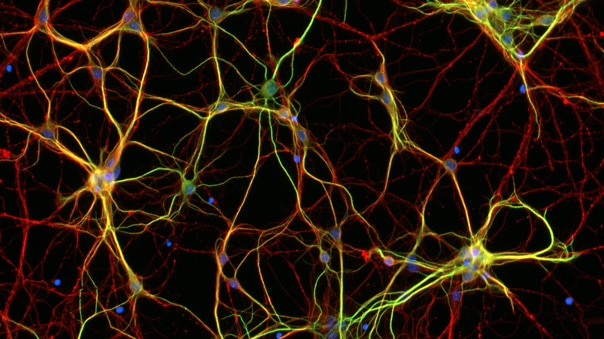 Advancing Neurobiology Research: Quantify Neurite Outgrowth with a Powerful Automated Solution