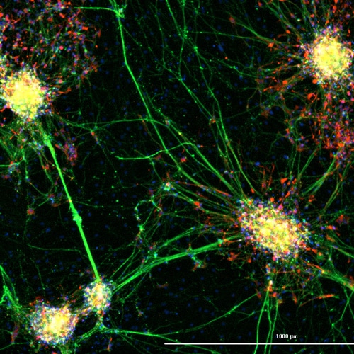 Human iPSC-derived neural progenitor cells undergoing differentiation into neurons