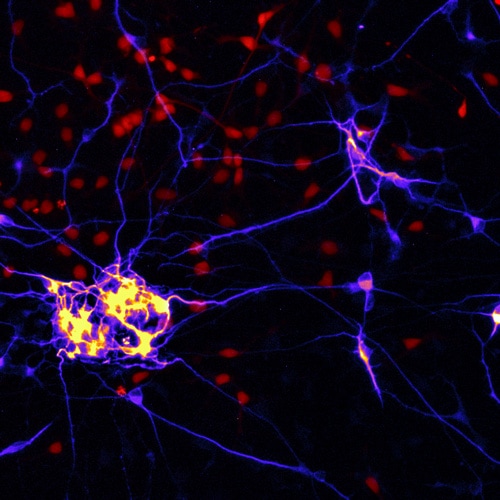 Human iPSC-derived neuronal clusters stained with MAP2 (Alexa Fluor 555, magenta) and neurofilament (Alexa Fluor 647, red) (10X objective). 