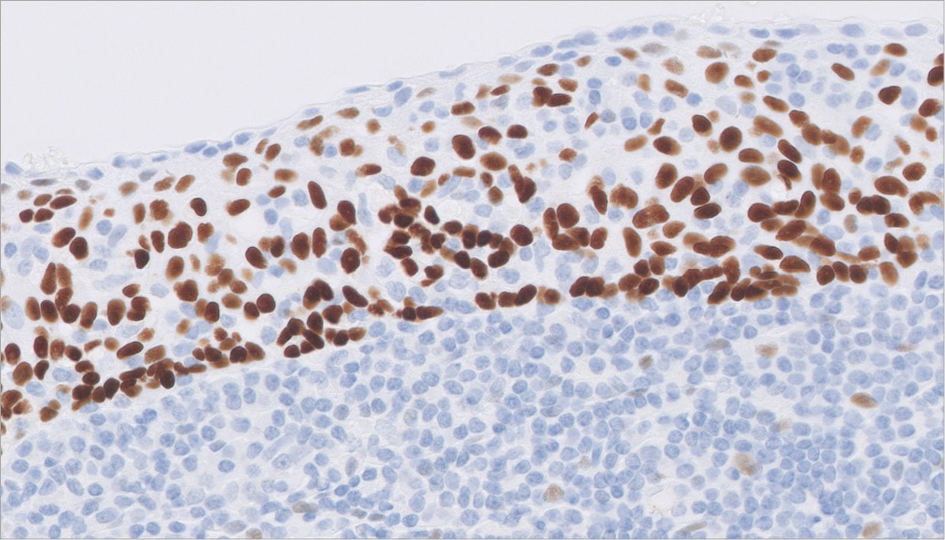 Tonsil stained with FLEX Anti-p63 Code GA662