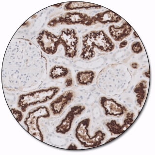 Renal Cell Carcinoma Marker (Dako Omnis)