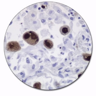Cytomegalovirus Antibody (Concentrate) | Agilent