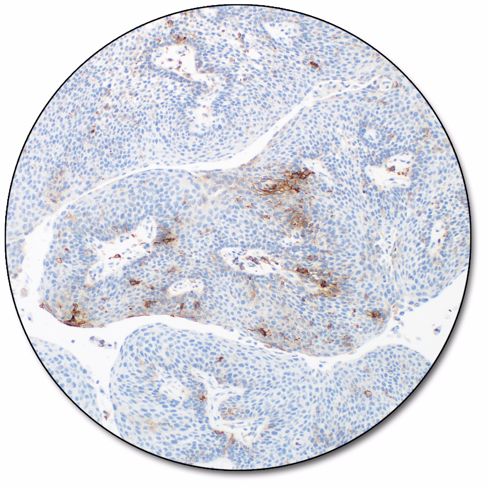 PD-L1 IHC 22C3 PharmDx For Use With Dako Omnis Agilent, 40% OFF