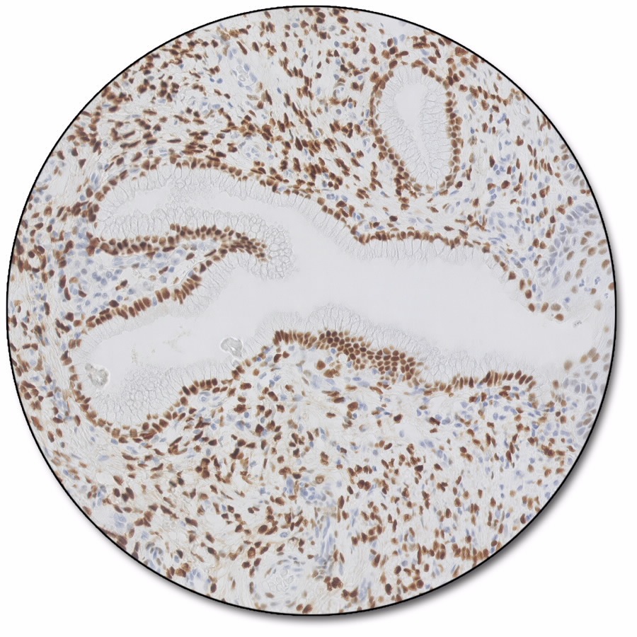 PD-L1 IHC 22C3 PharmDx For Use With Dako Omnis Agilent, 40% OFF