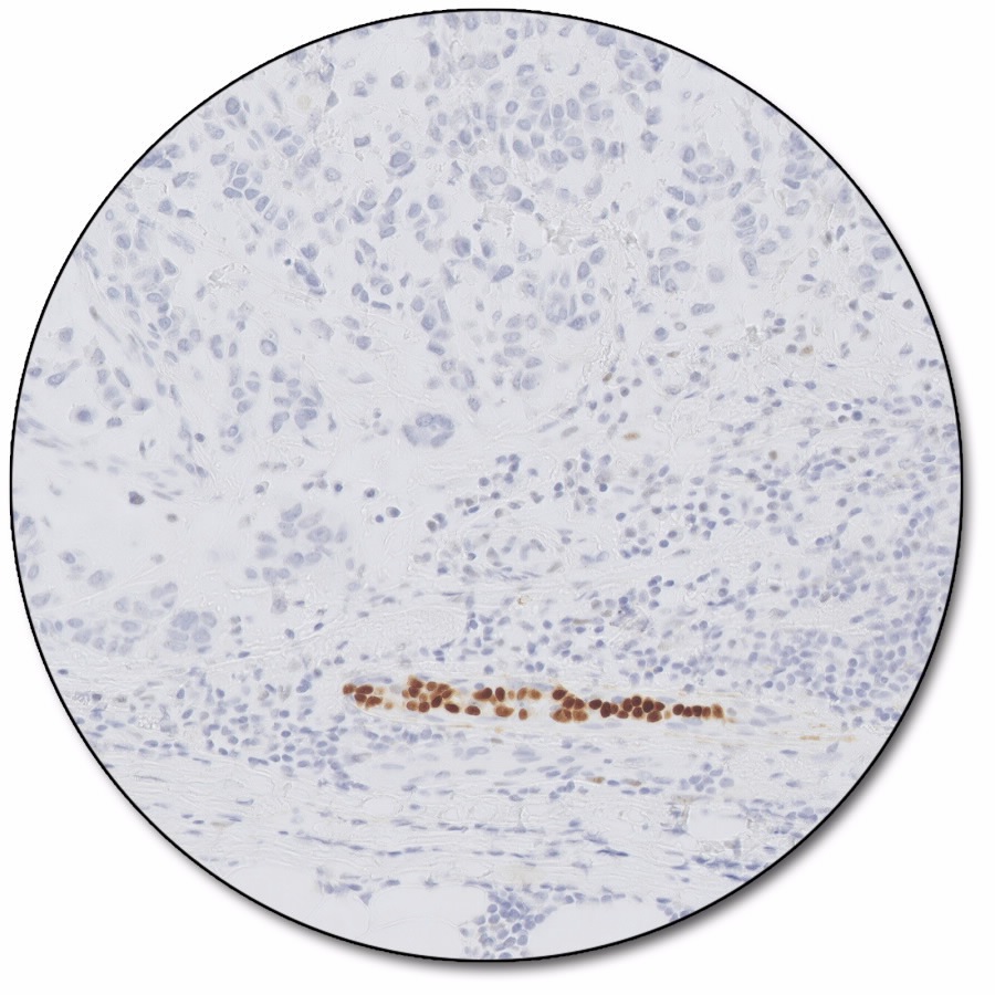 PD-L1 IHC 22C3 PharmDx For Use With Dako Omnis Agilent, 40% OFF