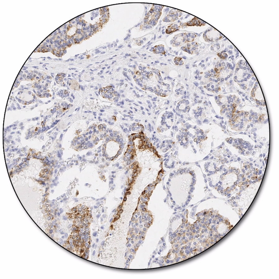 PD-L1 IHC 22C3 PharmDx For Use With Dako Omnis Agilent, 40% OFF