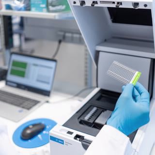 RNA ScreenTape Analysis